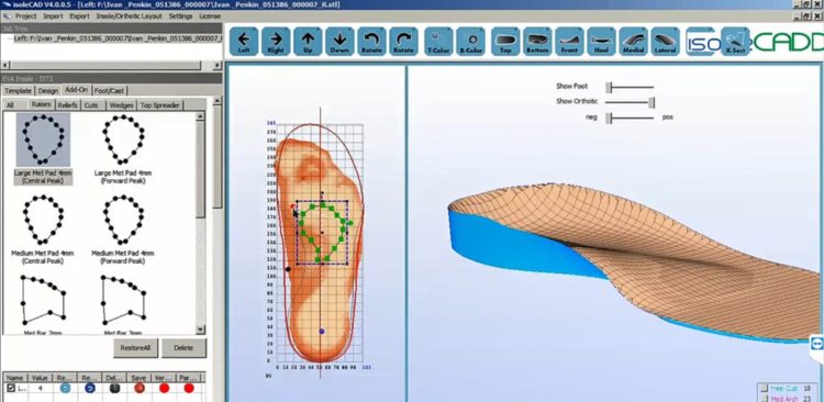 Screenshot of IsoleCAD program for creating insoles