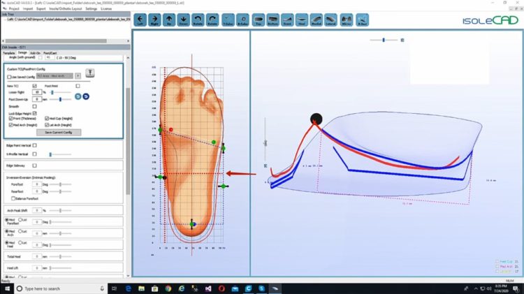 Screenshot of IsoleCAD program for creating insoles