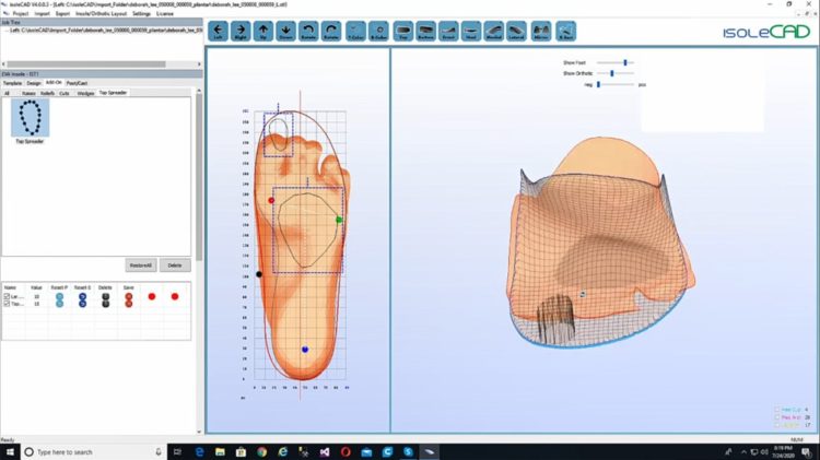 In the screenshot of the IsoleCAD program, the intersection for the fingers and the pad is being created.