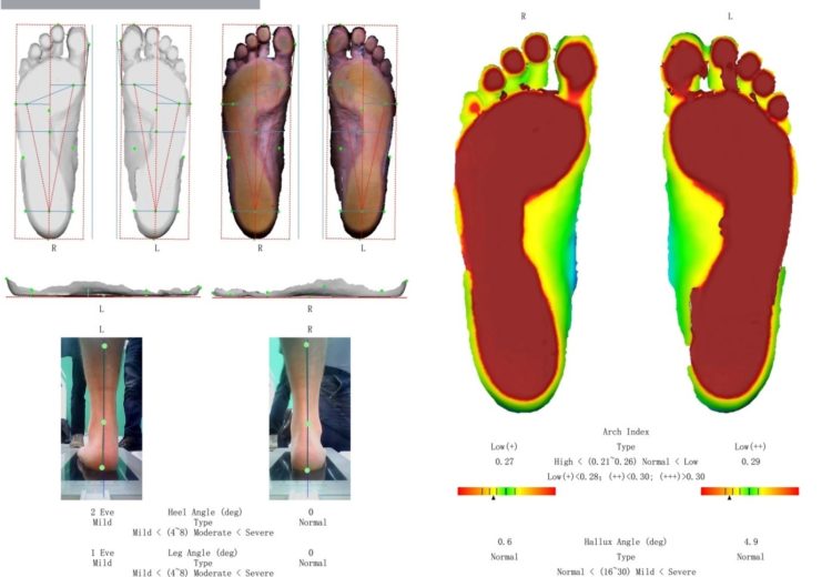 orthopedic 3D scans