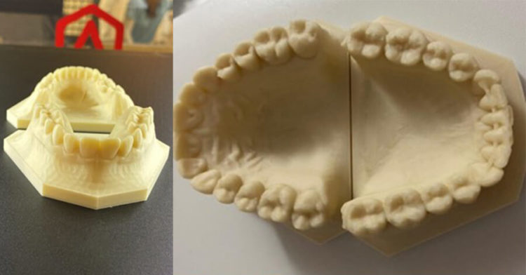 Open Filament Program allows Ortho Penthin to use special heat-resistant PLA