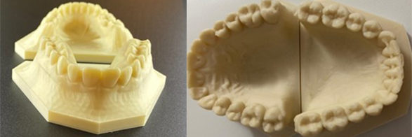 Ortho Pentin: Better Workflow Using 3D Printing for an Orthodontic Treatment System