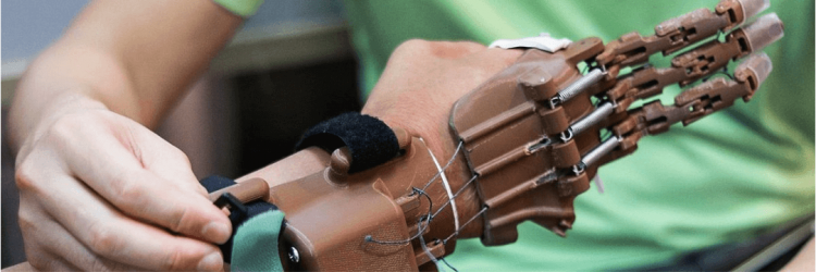 Prosthetics for Everyone Who Needs Them: 3D Printing Reduces Costs of Prosthetics